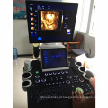 3d / 4D carrinho médico cor doppler &amp; sonography preço da máquina